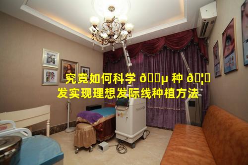 究竟如何科学 🐵 种 🦉 发实现理想发际线种植方法